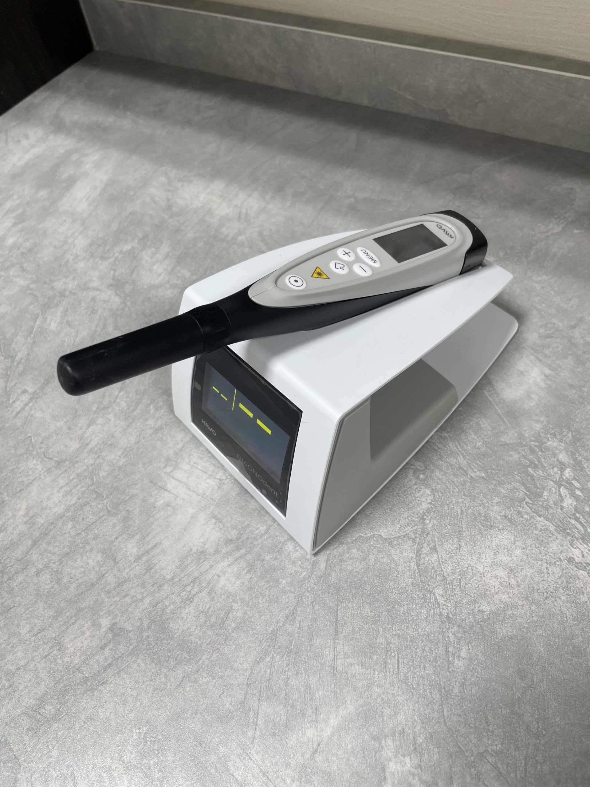 ダイアグノデントってなに？削らない虫歯予防のススメ - みずほ台駅前